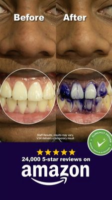 Health & Wellness Consideration Ad #1544 - Story 9:16