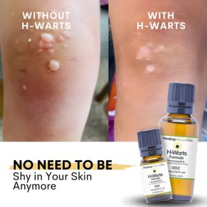 Health & Wellness Awareness Ad #1250 - Square 1:1